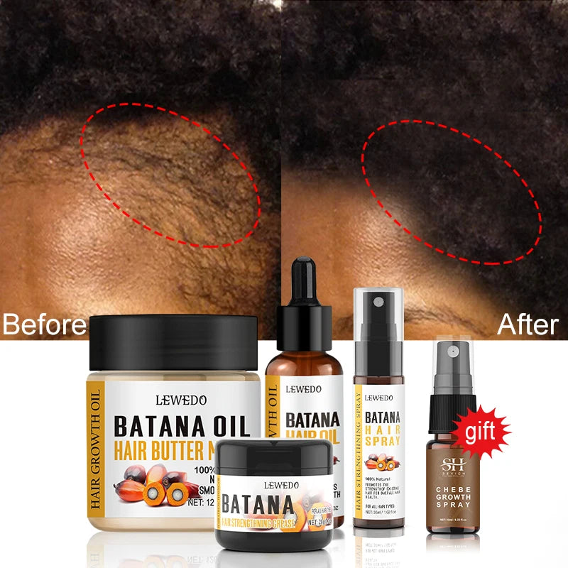 Ultimate Hair Renewal Oil - Batana Hair Mask & Strengthening Treatment